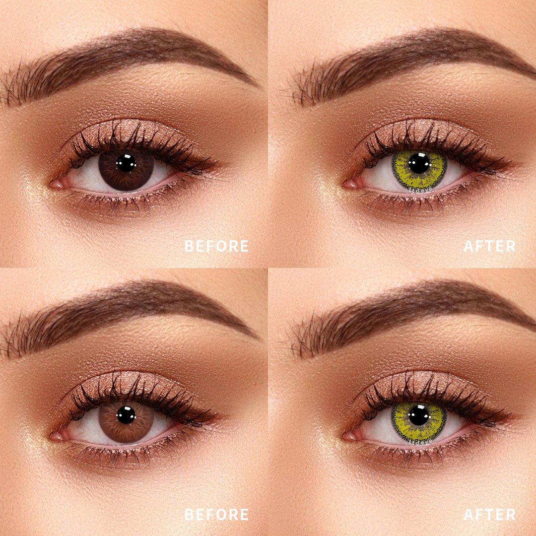 Luminareye AuraBurst Yellow | 1 Year